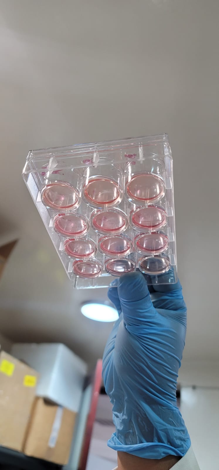 Chronisch-degenerativen Erkrankungen (Laboratory)